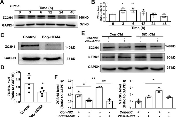 A Missing Piece Of The Puzzle In Pulmonary Fibrosis: Anoikis Resistance Promotes Fibroblast Activation