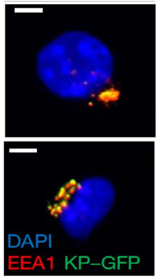 DC1_co-localizes_with_tumor_antigens.jpg